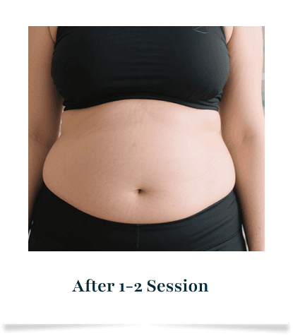 After 1–2 Sessions