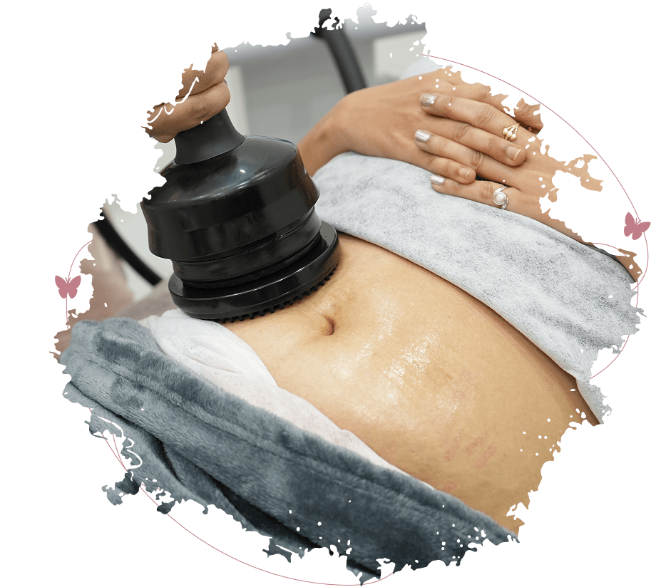 Laser hair removal treatment