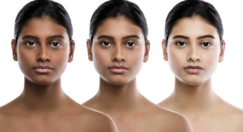 Skin Lightening Treatment - Safe Way To Look Young And Beautiful
