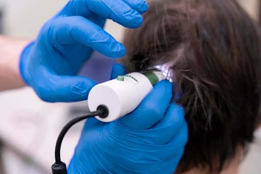 The Science Behind the Smooth: Understanding How Laser Technology Targets Hair Follicles