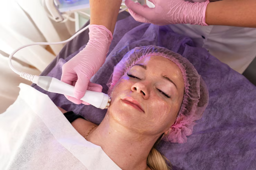 Laser vs. Acne Scars: A Guide to Effective Treatment Options